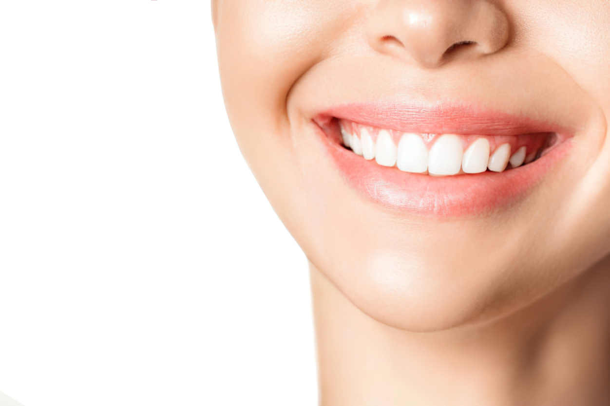 Insurance And Veneers